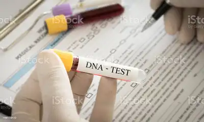 How Much Are Dna Test in Namibia?